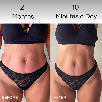 BodySculpt device