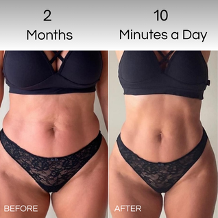 BodySculpt device
